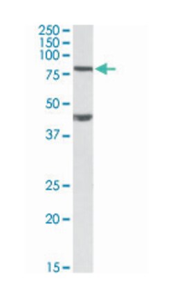 Dvl1, Goat, Polyclonal Antibody, Abnova 100 &mu;g | Buy Online | Abnova Corporation | Fisher Scientific
