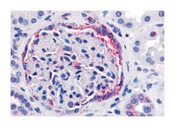 INPP5J Rabbit anti-Bovine, Dog, Hamster, Horse, Human, Monkey, Mouse, Pig, Rabbit, Rat, Polyclonal Antibody, Abnova 50 &mu;g | Buy Online | Abnova Corporation | Fisher Scientific