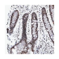 EFCAB10, Rabbit, Polyclonal Antibody, Abnova 100 &mu;L | Buy Online | Abnova Corporation | Fisher Scientific