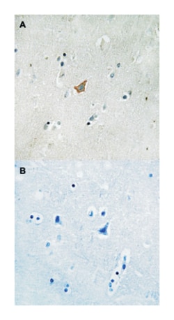 EPHA3/EPHA4/EPHA5, Rabbit, Polyclonal Antibody, Abnova 100 &mu;L | Buy Online | Abnova Corporation | Fisher Scientific