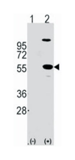 ALDH1A1 Rabbit anti-Human, Polyclonal Antibody, Abnova 400&mu;L; Unlabeled:Antibodies,