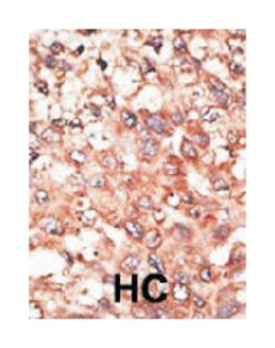 BMP5 Rabbit anti-Human, Polyclonal Antibody, Abnova 400&mu;L; Unlabeled:Antibodies,