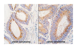 GDF11, Rabbit, Polyclonal Antibody, Abnova 400 &mu;L | Buy Online | Abnova Corporation | Fisher Scientific