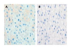 CPT1A, Rabbit, Polyclonal Antibody, Abnova 400 &mu;L | Buy Online | Abnova Corporation | Fisher Scientific