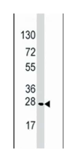 MOBKL1A, Rabbit, Polyclonal Antibody, Abnova 400 &mu;L | Buy Online | Abnova Corporation | Fisher Scientific