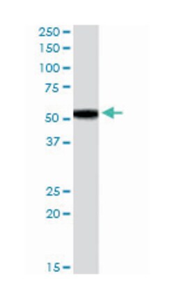 FOXC2, Goat, Polyclonal Antibody, Abnova 100 &mu;g | Buy Online | Abnova Corporation | Fisher Scientific