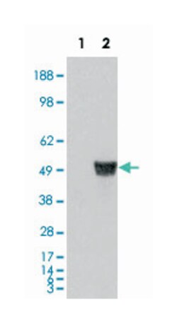 CORO1A, Goat, Polyclonal Antibody, Abnova 100 &mu;g | Buy Online | Abnova Corporation | Fisher Scientific