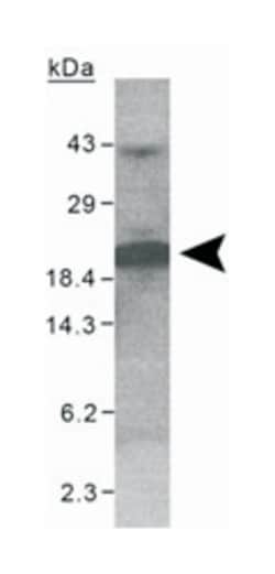 XAGE1, Rabbit, Polyclonal Antibody, Abnova 100 &mu;L | Buy Online | Abnova | Fisher Scientific