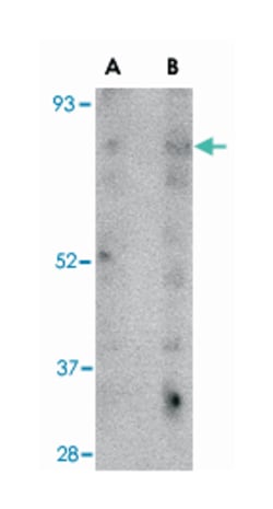 SCARB2 Rabbit anti-Human, Mouse, Polyclonal Antibody, Abnova 100&mu;g;