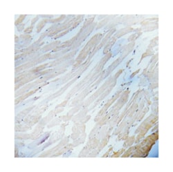 IKK-alpha/beta (phospho S180/S181), Rabbit anti-Human, Mouse, Rat, Polyclonal Antibody, Abnova 100 &mu;g | Buy Online | Abnova | Fisher Scientific