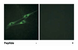 IL13RA1, Rabbit, Polyclonal Antibody, Abnova 100 &mu;g | Buy Online | Abnova | Fisher Scientific