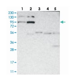 FER Rabbit anti-Human, Polyclonal Antibody, Abnova 100 &mu;L | Buy Online | Abnova Corporation | Fisher Scientific