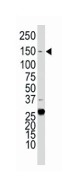 KDR Rabbit anti-Human, Polyclonal Antibody, Abnova 400 &mu;L | Buy Online | Abnova Corporation | Fisher Scientific