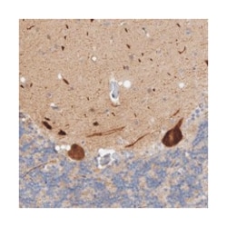 ZNF804B, Rabbit, Polyclonal Antibody, Abnova 100&mu;L; Unlabeled:Antibodies,