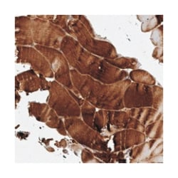 GPR31 Rabbit anti-Human, Polyclonal Antibody, Abnova 100 &mu;L | Buy Online | Abnova Corporation | Fisher Scientific