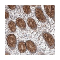 LGSN, Rabbit, Polyclonal Antibody, Abnova 100&mu;L; Unlabeled:Antibodies,