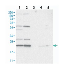 MED28 Rabbit anti-Human, Mouse, Rat, Polyclonal Antibody, Abnova 100&mu;L;