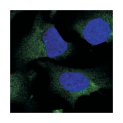 NIT2, Rabbit, Polyclonal Antibody, Abnova 100 &mu;L | Buy Online | Abnova Corporation | Fisher Scientific