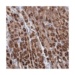 SUCLA2, Rabbit, Polyclonal Antibody, Abnova 100 &mu;L | Buy Online | Abnova Corporation | Fisher Scientific