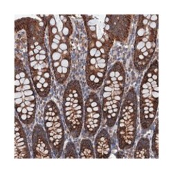 C14orf159, Rabbit, Polyclonal Antibody, Abnova 100&mu;L; Unlabeled:Antibodies,