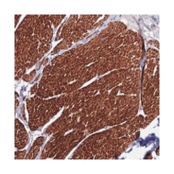 KIAA0664, Rabbit, Polyclonal Antibody, Abnova 100&mu;L; Unlabeled:Antibodies,