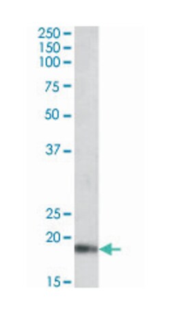 NPPA, Goat, Polyclonal Antibody, Abnova 100 &mu;g | Buy Online | Abnova Corporation | Fisher Scientific