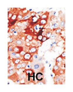 ACSL4, Rabbit, Polyclonal Antibody, Abnova 400&mu;L; Unlabeled:Antibodies,