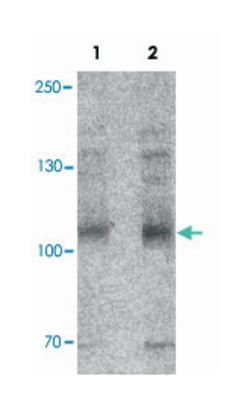 THBS4, Rabbit, Polyclonal Antibody, Abnova 100 &mu;g | Buy Online | Abnova Corporation | Fisher Scientific