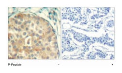 CFL1/CFL2 (phospho Y88), Rabbit anti-Human, Mouse, Rat, Polyclonal Antibody,
