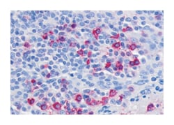 CCR6 Rabbit anti-Human, Polyclonal Antibody, Abnova 50&mu;g; Unlabeled:Antibodies,