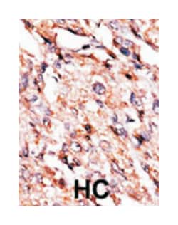 BCKDK Rabbit anti-Human, Polyclonal Antibody, Abnova 400&mu;L; Unlabeled:Antibodies,