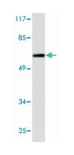 MMP19 Rabbit anti-Human, Mouse, Polyclonal Antibody, Abnova 100&mu;L; Unlabeled:Antibodies,