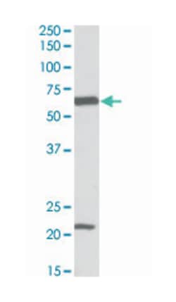 SLC1A3 Goat anti-Human, Rat, Polyclonal Antibody, Abnova 100 &mu;g | Buy Online | Abnova Corporation | Fisher Scientific