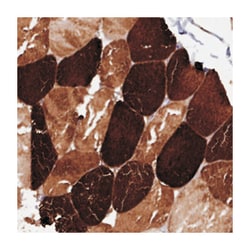 ANKRD2 Rabbit anti-Human, Polyclonal Antibody, Abnova 100 &mu;L | Buy Online | Abnova Corporation | Fisher Scientific