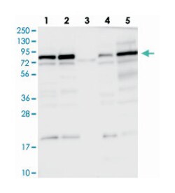 DENND1C Rabbit anti-Human, Polyclonal Antibody, Abnova 100 &mu;L | Buy Online | Abnova Corporation | Fisher Scientific