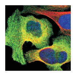AHNAK2, Rabbit, Polyclonal Antibody, Abnova 100 &mu;L | Buy Online | Abnova Corporation | Fisher Scientific