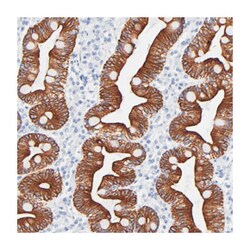 KRT19 Rabbit anti-Human, Polyclonal Antibody, Abnova 100&mu;L; Unlabeled:Antibodies,
