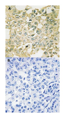 PKMYT1 (phospho S83), Rabbit anti-Human, Polyclonal Antibody, Abnova 100&mu;L;