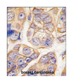 CDH13 Rabbit anti-Human, Polyclonal Antibody, Abnova 400 &mu;L | Buy Online | Abnova Corporation | Fisher Scientific