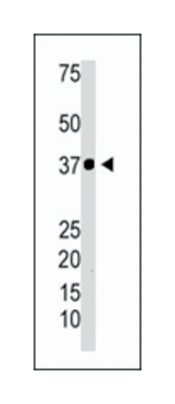 NFKBIA Rabbit anti-Human, Polyclonal Antibody, Abnova 400&mu;L; Unlabeled:Antibodies,