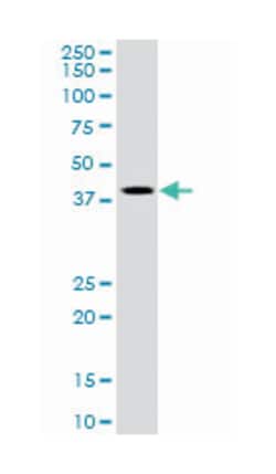 TIMM50, Goat, Polyclonal Antibody, Abnova 100 &mu;g | Buy Online | Abnova Corporation | Fisher Scientific