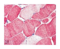ARSB, Goat, Polyclonal Antibody, Abnova 100 &mu;g | Buy Online | Abnova | Fisher Scientific