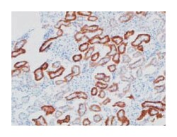 CD98, Rabbit, Polyclonal Antibody, Abnova 25 &mu;g | Buy Online | Abnova | Fisher Scientific