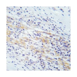 GAB1 Rabbit anti-Human, Mouse, Rat, Polyclonal Antibody, Abnova 100&mu;g;