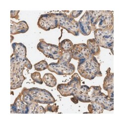 SLC30A10, Rabbit, Polyclonal Antibody, Abnova 100 &mu;L | Buy Online | Abnova Corporation | Fisher Scientific