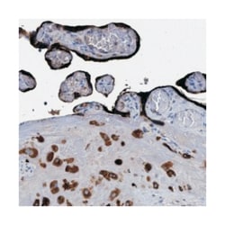 PAPPA2 Rabbit anti-Human, Polyclonal Antibody, Abnova 100&mu;L; Unlabeled:Antibodies,