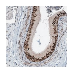 C9orf78 Rabbit anti-Human, Polyclonal Antibody, Abnova 100 &mu;L | Buy Online | Abnova Corporation | Fisher Scientific