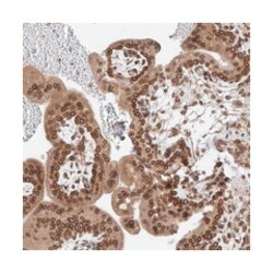 AHCTF1, Rabbit, Polyclonal Antibody, Abnova 100 &mu;L | Buy Online | Abnova Corporation | Fisher Scientific