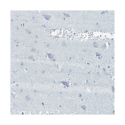 BFSP2, Rabbit, Polyclonal Antibody, Abnova 100&mu;L; Unlabeled:Antibodies,