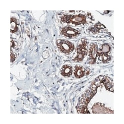 NEK1 Rabbit anti-Human, Polyclonal Antibody, Abnova 100 &mu;L | Buy Online | Abnova Corporation | Fisher Scientific